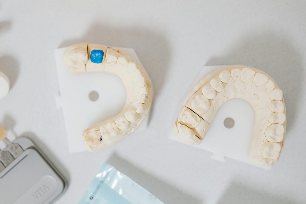 Dental impression models showing teeth before and after treatment planning.